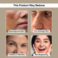 Skin Brightening Vitamin C Face Serum (Vitamin C + 0.5 % Ferulic Acid) | 30ML