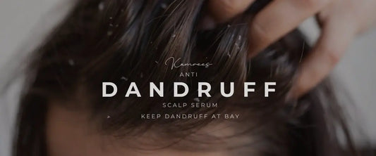 Anti-Dandruff Scalp Serum- To Keep Dandruff at Bay
